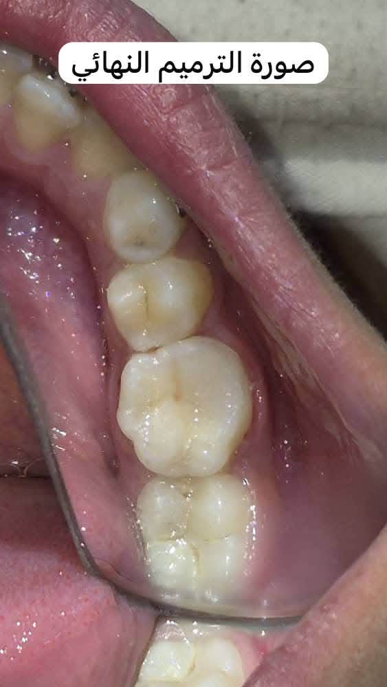 Dental clinic shares a case followed by Dr Mazen Obid