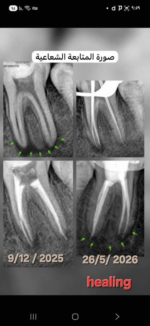 Dental clinic shares a case followed by Dr Mazen Obid — photo 2