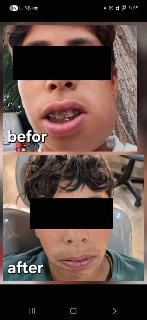 Dental clinic shares a case followed by Dr Mazen Obid — photo 3